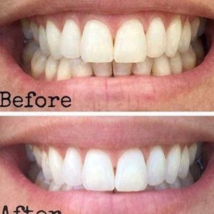 Whitening toothpaste